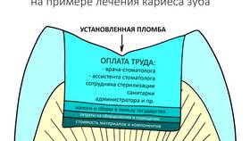 Что называют статьей расходов в Ариант